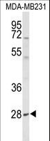 YIPF5 Antibody - Western blot of YIPF5 Antibody in MDA-MB231 cell line lysates (35 ug/lane). YIPF5 (arrow) was detected using the purified antibody;