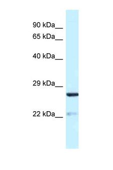 YIPF5 Antibody - YIPF5 antibody Western blot of Mouse Spleen lysate. Antibody concentration 1 ug/ml.  This image was taken for the unconjugated form of this product. Other forms have not been tested.