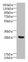 YIPF5 Antibody - Western blot All lanes: YIPF5 antibody at 5µg/ml + Mouse liver tissue Secondary Goat polyclonal to rabbit IgG at 1/10000 dilution Predicted band size: 28, 22, 30 kDa Observed band size: 28 kDa