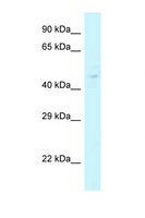 YKL39 / CHI3L2 Antibody - CHI3L2 antibody Western blot of Fetal Liver lysate. Antibody concentration 1 ug/ml.  This image was taken for the unconjugated form of this product. Other forms have not been tested.