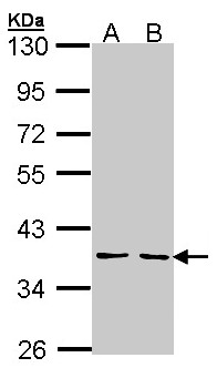 YKL39 / CHI3L2 Antibody - Sample (30 ug of whole cell lysate). A: H1299, B: Hela. 10% SDS PAGE. YKL39 / CHI3L2 antibody diluted at 1:1000.