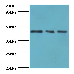 YKL39 / CHI3L2 Antibody - Western blot. All lanes: CHI3L2 antibody at 4 ug/ml. Lane 1: HeLa whole cell lysate. Lane 2: Rat brain tissue. Lane 3: A431 whole cell lysate. Secondary antibody: Goat polyclonal to rabbit at 1:10000 dilution. Predicted band size: 44 kDa. Observed band size: 44 kDa.