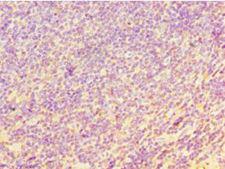 YKL39 / CHI3L2 Antibody - Immunohistochemistry of paraffin-embedded human tonsil tissue using antibody at 1:100 dilution.
