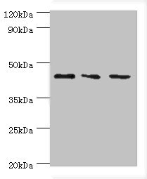 YKL39 / CHI3L2 Antibody - Western blot All lanes: CHI3L2 antibody at 4µg/ml Lane 1: Hela whole cell lysate Lane 2: Rat brain tissue Lane 3: A431 whole cell lysate Secondary Goat polyclonal to rabbit IgG at 1/10000 dilution Predicted band size: 44, 35, 43 kDa Observed band size: 44 kDa