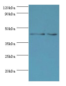 YKL39 / CHI3L2 Antibody - Western blot. All lanes: CHI3L2 antibody at 4 ug/ml. Lane 1: Rat brain tissue. Lane 2: A431 whole cell lysate. Secondary antibody: Goat polyclonal to rabbit at 1:10000 dilution. Predicted band size: 44 kDa. Observed band size: 44 kDa.