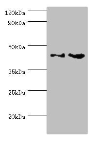 YKL39 / CHI3L2 Antibody - Western blot All lanes: CHI3L2 antibody at 4µg/ml Lane 1: Rat brain tissue Lane 2: A431 whole cell lysate Secondary Goat polyclonal to rabbit IgG at 1/10000 dilution Predicted band size: 44, 35, 43 kDa Observed band size: 44 kDa