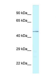 YKL39 / CHI3L2 Antibody - CHI3L2 antibody Western blot of Fetal Brain lysate. Antibody concentration 1 ug/ml.  This image was taken for the unconjugated form of this product. Other forms have not been tested.
