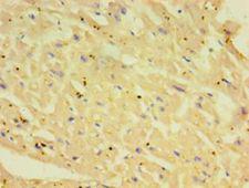 YKL39 / CHI3L2 Antibody - Immunohistochemistry of paraffin-embedded human heart tissue using antibody at 1:100 dilution.  This image was taken for the unconjugated form of this product. Other forms have not been tested.