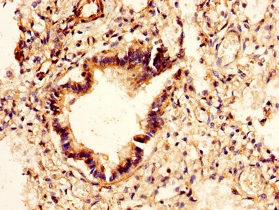 YKL39 / CHI3L2 Antibody - IHC image of CHI3L2 Antibody diluted at 1:400 and staining in paraffin-embedded human lung tissue performed on a Leica BondTM system. After dewaxing and hydration, antigen retrieval was mediated by high pressure in a citrate buffer (pH 6.0). Section was blocked with 10% normal goat serum 30min at RT. Then primary antibody (1% BSA) was incubated at 4°C overnight. The primary is detected by a biotinylated secondary antibody and visualized using an HRP conjugated SP system.