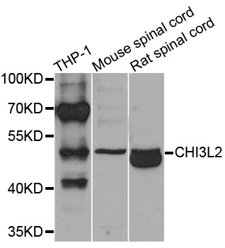 YKL39 / CHI3L2 Antibody - Western blot analysis of extracts of various cells.