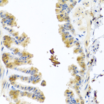 YKL39 / CHI3L2 Antibody - Immunohistochemistry of paraffin-embedded mouse lung tissue.