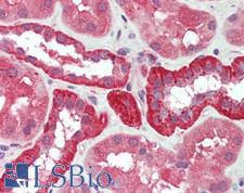 YKL39 / CHI3L2 Antibody - Human Kidney: Formalin-Fixed, Paraffin-Embedded (FFPE)