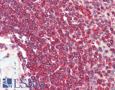 YKL39 / CHI3L2 Antibody - Human Spleen: Formalin-Fixed, Paraffin-Embedded (FFPE)