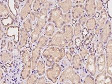 YKL39 / CHI3L2 Antibody - Immunochemical staining of human CHI3L2 in human kidney with rabbit polyclonal antibody at 1:100 dilution, formalin-fixed paraffin embedded sections.