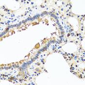 YKL39 / CHI3L2 Antibody - Immunohistochemistry of paraffin-embedded Rat lung using CHI3L2 Polyclonal Antibody at dilution of 1:100 (40x lens).