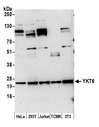 YKT6 Antibody - Detection of human and mouse YKT6 by western blot. Samples: Whole cell lysate (15 µg) from HeLa, HEK293T, Jurkat, mouse TCMK-1, and mouse NIH 3T3 cells prepared using NETN lysis buffer. Antibody: Affinity purified rabbit anti-YKT6 antibody used for WB at 0.1 µg/ml. Detection: Chemiluminescence with an exposure time of 3 minutes.