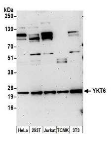 YKT6 Antibody - Detection of human and mouse YKT6 by western blot. Samples: Whole cell lysate (15 µg) from HeLa, HEK293T, Jurkat, mouse TCMK-1, and mouse NIH 3T3 cells prepared using NETN lysis buffer. Antibody: Affinity purified rabbit anti-YKT6 antibody used for WB at 0.1 µg/ml. Detection: Chemiluminescence with an exposure time of 3 minutes.