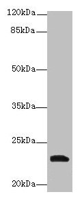 YKT6 Antibody - Western blot All lanes: YKT6 antibody at 12µg/ml + A549 whole cell lysate Secondary Goat polyclonal to rabbit IgG at 1/10000 dilution Predicted band size: 23, 19 kDa Observed band size: 23 kDa