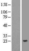 YKT6 Protein - Western validation with an anti-DDK antibody * L: Control HEK293 lysate R: Over-expression lysate