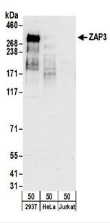 YLPM1 Antibody - Detection of Human ZAP3 by Western Blot. Samples: Whole cell lysate (50 ug) from 293T, HeLa, and Jurkat cells. Antibodies: Affinity purified rabbit anti-ZAP3 antibody used for WB at 0.1 ug/ml. Detection: Chemiluminescence with an exposure time of 30 seconds.