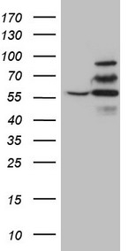 YME1L1 Antibody - HEK293T cells were transfected with the pCMV6-ENTRY control. (Left lane) or pCMV6-ENTRY YME1L1. (Right lane) cDNA for 48 hrs and lysed. Equivalent amounts of cell lysates. (5 ug per lane) were separated by SDS-PAGE and immunoblotted with anti-YME1L1. (1:2000)