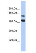 YME1L1 Antibody - YME1L1 antibody Western Blot of SH-SYSY. Antibody dilution: 1 ug/ml.  This image was taken for the unconjugated form of this product. Other forms have not been tested.
