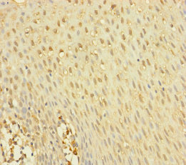 YME1L1 Antibody - Immunohistochemistry of paraffin-embedded human tonsil tissue at dilution of 1:100