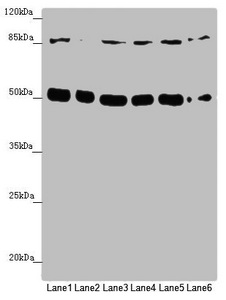YME1L1 Antibody - Western blot All Lanes: YME1L1 antibody at 3.8 ug/ml Lane 1: A549 whole cell lysate Lane 2: Jurkat whole cell lysate Lane 3: A431 whole cell lysate Lane 4: Hela whole cell lysate Lane 5: HepG-2 whole cell lysate Lane 6: MCF7 whole cell lysate Secondary Goat polyclonal to rabbit IgG at 1/10000 dilution Predicted band size: 87,80,76 kDa Observed band size: 86,50 kDa