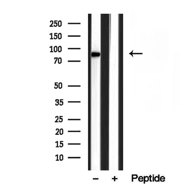 YME1L1 Antibody - Western blot analysis of extracts of mouse heart tissue using YME1L1 antibody.