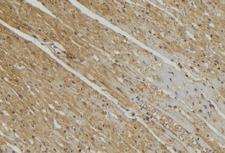 YME1L1 Antibody - 1:100 staining mouse muscle tissue by IHC-P. The sample was formaldehyde fixed and a heat mediated antigen retrieval step in citrate buffer was performed. The sample was then blocked and incubated with the antibody for 1.5 hours at 22°C. An HRP conjugated goat anti-rabbit antibody was used as the secondary.
