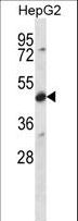Yo / CDR2 Antibody - CDR2 Antibody western blot of HepG2 cell line lysates (35 ug/lane). The CDR2 antibody detected the CDR2 protein (arrow).