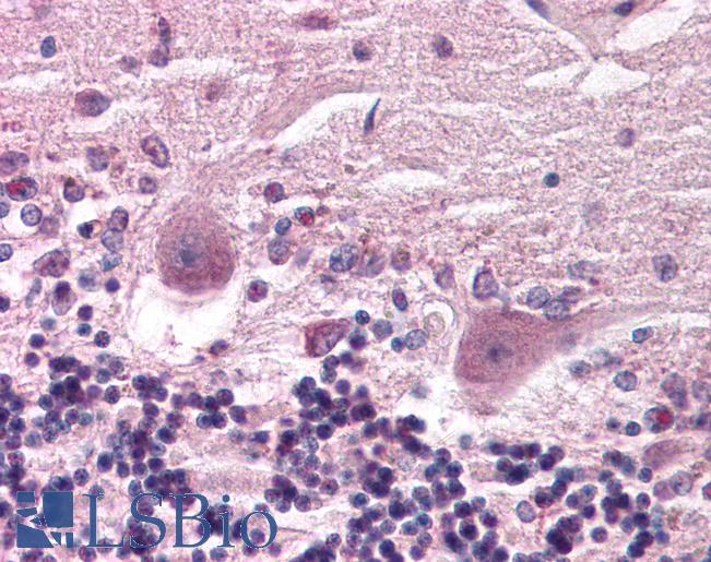Yo / CDR2 Antibody - Brain, cerebellum.  This image was taken for the unconjugated form of this product. Other forms have not been tested.