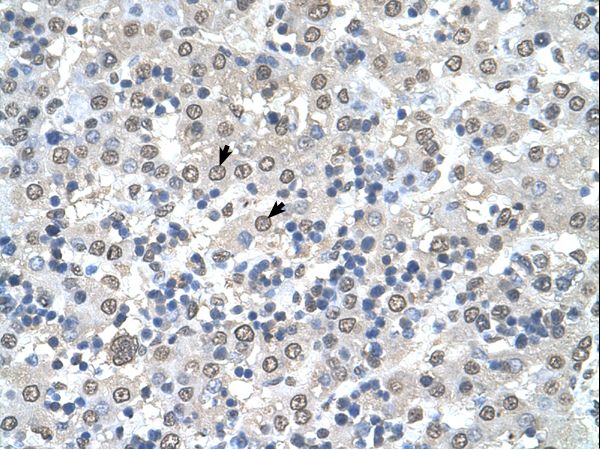 Yo / CDR2 Antibody - CDR2 antibody CDR2(cerebellar degeneration-related protein 2, 62kDa) Antibody was used in IHC to stain formalin-fixed, paraffin-embedded human liver.  This image was taken for the unconjugated form of this product. Other forms have not been tested.