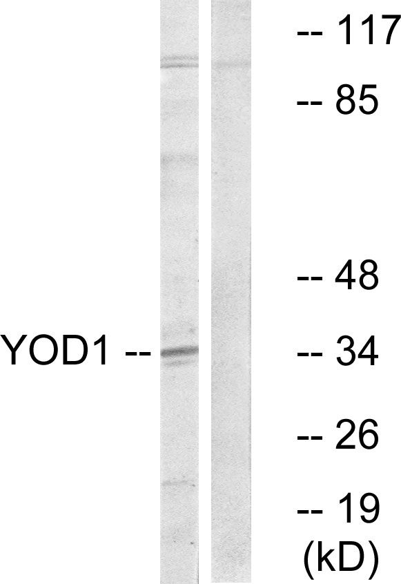 YOD1 Antibody - Western blot analysis of lysates from COLO cells, using YOD1 Antibody. The lane on the right is blocked with the synthesized peptide.