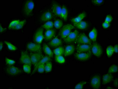 YOD1 Antibody - Immunofluorescence staining of A549 cells diluted at 1:166, counter-stained with DAPI. The cells were fixed in 4% formaldehyde, permeabilized using 0.2% Triton X-100 and blocked in 10% normal Goat Serum. The cells were then incubated with the antibody overnight at 4°C.The Secondary antibody was Alexa Fluor 488-congugated AffiniPure Goat Anti-Rabbit IgG (H+L).