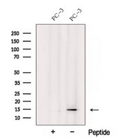 YPEL3 Antibody - Western blot analysis of extracts of PC-3 cells using YPEL3 antibody. The lane on the left was treated with blocking peptide.