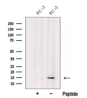 YPEL3 Antibody - Western blot analysis of extracts of PC-3 cells using YPEL3 antibody. The lane on the left was treated with blocking peptide.