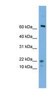 YPEL5 Antibody - YPEL5 antibody Western blot of HeLa lysate. This image was taken for the unconjugated form of this product. Other forms have not been tested.
