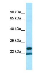 YRDC Antibody - YRDC antibody Western Blot of ACHN.  This image was taken for the unconjugated form of this product. Other forms have not been tested.