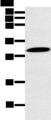 YRDC Antibody - Western blot analysis of Mouse stomach tissue  using YRDC Polyclonal Antibody at dilution of 1:250