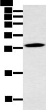 YRDC Antibody - Western blot analysis of Mouse stomach tissue  using YRDC Polyclonal Antibody at dilution of 1:400