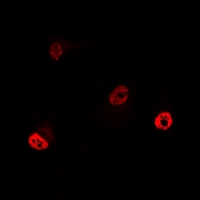 YTHDC1 Antibody - Immunofluorescent analysis of YT521-B staining in MCF7 cells. Formalin-fixed cells were permeabilized with 0.1% Triton X-100 in TBS for 5-10 minutes and blocked with 3% BSA-PBS for 30 minutes at room temperature. Cells were probed with the primary antibody in 3% BSA-PBS and incubated overnight at 4 deg C in a humidified chamber. Cells were washed with PBST and incubated with a DyLight 594-conjugated secondary antibody (red) in PBS at room temperature in the dark.