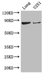 YTHDC1 Antibody - Positive WB detected in:Mouse lung tissue,U251 whole cell lysate;All lanes: YTHDC1 antibody at 3.4ug/ml;Secondary;Goat polyclonal to rabbit IgG at 1/50000 dilution;Predicted band size: 85,83 kDa;Observed band size: 85 kDa;