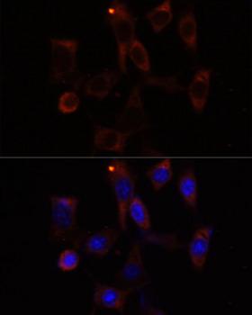 YTHDC2 Antibody - Immunofluorescence analysis of NIH/3T3 cells using YTHDC2 Polyclonal Antibody at dilution of 1:100.Blue: DAPI for nuclear staining.