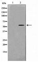 YTHDF1 Antibody - Western blot of 293 cell lysate using YTHDF1 Antibody