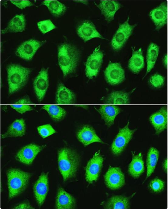 YTHDF1 Antibody - Immunofluorescence analysis of L929 cells using YTHDF1 Rabbit pAb at dilution of 1:100. Blue: DAPI for nuclear staining.