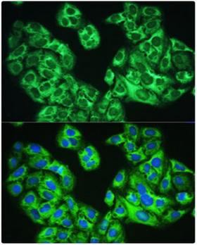 YTHDF1 Antibody - Immunofluorescence analysis of U2OS cells using YTHDF1 Rabbit pAb at dilution of 1:100. Blue: DAPI for nuclear staining.