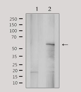 YTHDF1 Antibody - Western blot analysis of extracts of 293 cells using YTHDF1 antibody.