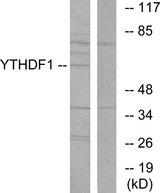 YTHDF1 Antibody - Western blot analysis of extracts from 293 cells, using YTHDF1 antibody.
