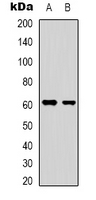 YTHDF1 Antibody - Western blot analysis of YTHDF1 expression in HepG2 (A); HEK293T (B) whole cell lysates.